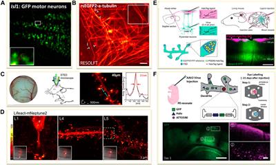 Super-Resolution Microscopy: Shedding New Light on In Vivo Imaging